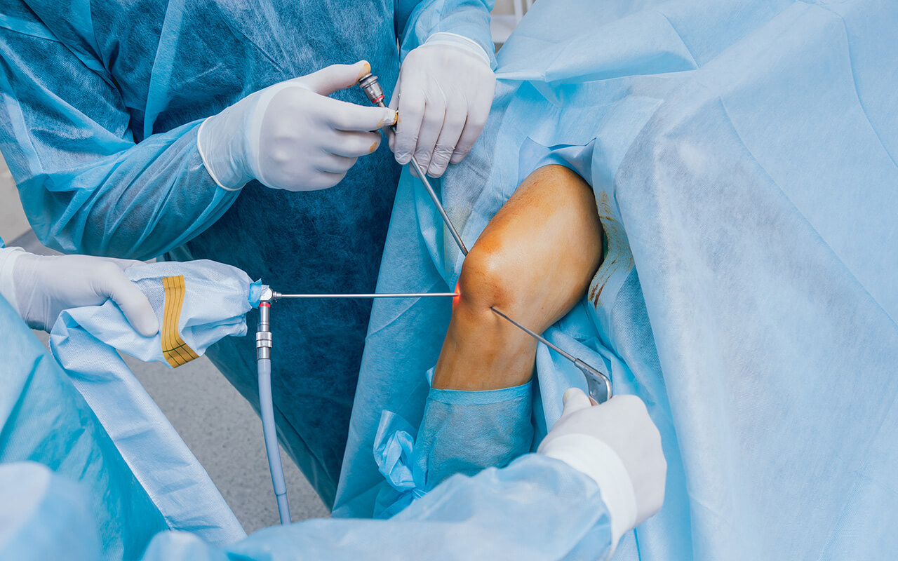 minimalno invazivna operacija zamene kolena | Trendovi u medicini, Zdravlje i prevencija, lečenje, magazin
